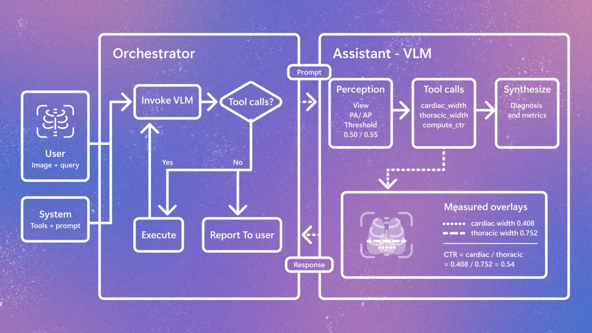 Microsoft Research presenta CARE-X, modelo de IA de investigación para radiología de tórax