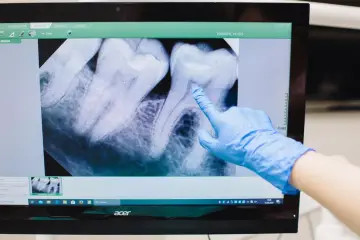 Fotografía de archivo que ilustra: Henry Schein One procesa 11 millones de radiografías dentales con verificación IA en tiempo real