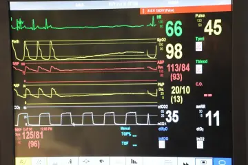 Fotografía de archivo que ilustra: ONCO-ACS: modelo de IA para predecir riesgos en infartos de pacientes con cáncer