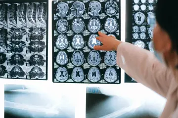 Fotografía de archivo que ilustra: Microsoft Research y Numenta comparan inteligencia de máquinas con la del cerebro humano