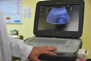 Startups del programa NVIDIA Inception aplican IA al diagnóstico y tratamiento del cáncer de mama