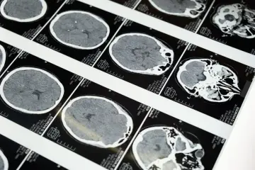 Instituto Weizmann desarrolla IA que reconstruye imágenes a partir de la actividad cerebral