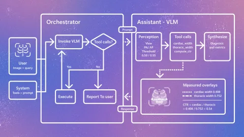 Microsoft Research presenta CARE-X, modelo de IA de investigación para radiología de tórax