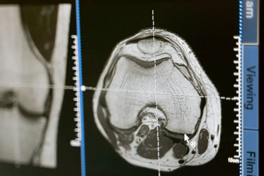 Investigadores del Instituto Weizmann crean Brain-IT, un modelo de IA que reconstruye imágenes vistas a partir de escáneres cerebrales