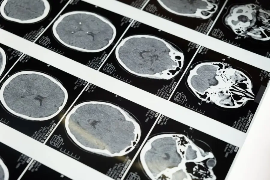 Instituto Weizmann desarrolla IA que reconstruye imágenes a partir de la actividad cerebral
