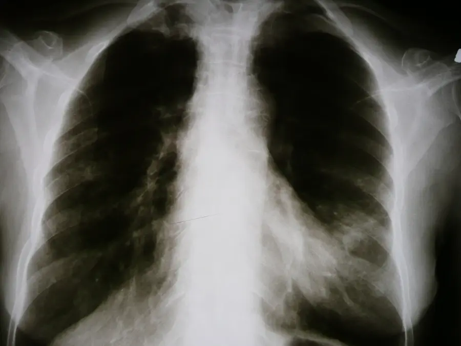 Fotografía de archivo que ilustra: Microsoft Research presenta CARE-X, modelo de IA de investigación para radiología de tórax