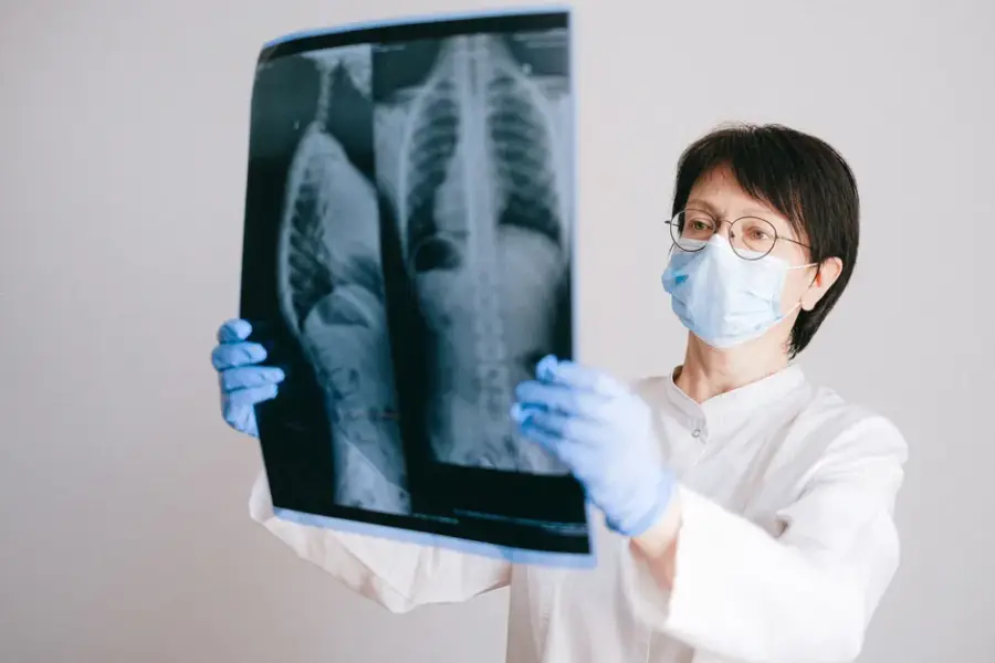 Fotografía de archivo que ilustra: Google Research y Nexus AI llevan la detección de tuberculosis por IA a clínicas de seis países